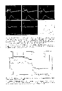 Рис. 5. Осциллограммы двухфазных составных потенциалов действия малоберцового нерва (верхняя запись) и сокращения передней большеберцовой мышцы (нижняя запись) в ответ на раздражение седалищного нерва (2 в, 0,1 мсек). Первое слева отклонение в записи соответствует артефакту, вызванному распространением раздражающего тока (по Evans, 1965)