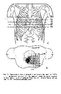 Рис. 2.2. Расположение сердца в <a href="/info/1278116">грудной клетке</a> (<a href="/info/1472997">упрощенная схема</a> из [146]) а - фронтальная проекция б - трасверсальное сечение на уровне геометрического центра желудочков (сечение 826) ЬА, НА — левое и правое предсердия ЬУ, НУ- левый и правый желудочки