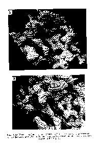 Рис. 16,19. Модель карбоангидразы человека (Л) и ее комплекса с ацетоксимер-курсульфаниламидом (Б), выполненная по <a href="/info/163659">картам электронной плотности</a> с разрешением 5,5 А [22].