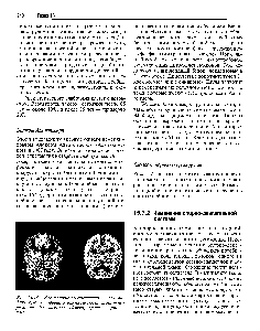 Рис. 15.23. <a href="/info/1566320">Результаты компьютерного</a> томографического сканирования <a href="/info/70047">головного мозга</a> слева — пораженного <a href="/info/186983">болезнью Альцгеймера</a>, справа — нормального.