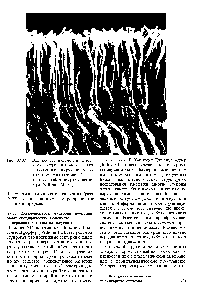 Рис. 37.37. Вид оеток - палочек и колбочек - фоторецепторного слоя сетчатки в <a href="/info/129221">сканирующем электронном микроскопе</a>. (Печатается с любезного разрещения д-ра William МШет)