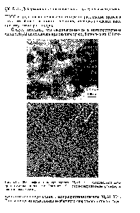 Рис. 5.14. Фотографии наноструктурного №зА1 а — <a href="/info/1594511">светлопольное</a> <a href="/info/57033">электронно-микроскопическое</a> изображение 5 — высокоразрешающая фотография двойниковых границ