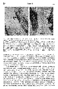 Рис. 12.6. Локализация натрия и кальция в <a href="/info/509326">нервной ткани методом</a> осаждения с использованием пироантимоната осмия [417].