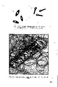 Рис. II—7. Вид жгутиков в <a href="/info/12327">электронном микроскопе</a> (увеличение