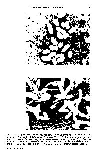 Рис. 4.11. Микрофотографии, полученные на <a href="/info/129221">сканирующем электронном микроскопе</a>, бактерий Pseudomonas diminuta АТСС 19146, выращенных в солевом лактозном бульоне (а) и в соево-казеиновом бульоне (б). Заметна разница в <a href="/info/1344891">размерах бактерий</a>. На <a href="/info/975344">обоих рисунках</a> масштабные метки имеют длину 1 мкм. (С разрешения Т. Лихи, фирма Миллипор корпорейшн .)