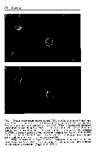 Рис. 1. Взвесь отвечающих клеток мышей СВА, освобожденная от В-лимфоцитов, <a href="/info/1330306">была</a> активирована в СКЛ <a href="/info/1034950">стимулирующими клетками</a> мышей SJL. Т-бласты обрабатывали сывороткой анти-Н-2 (1/20) и подвергали <a href="/info/1383395">двойному окрашиванию</a>, как описано в тексте, — сначала <a href="/info/1903686">кроличьей сывороткой</a> анти-Т (выявляемой с помощью <a href="/info/1393015">бараньей антисыворотки</a> к кроличьему Ig, меченной ТРИТЦ), а затем <a href="/info/1393015">бараньей антисывороткой</a> к мышиному Ig, меченной ФИТЦ. Одни и те же клетки наблюдали при освещении, возбуждающем флуоресценцию вначале родамина, а затем флуоресцеина.