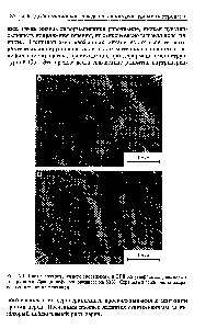 Рис. 5.4. Следы внутризеренного скольжения и ЗГП на углеродных репликах с <a href="/info/1524223">поверхности образца</a>, деформированного на 53%. Стрелками обозначены направления оттенения платиной